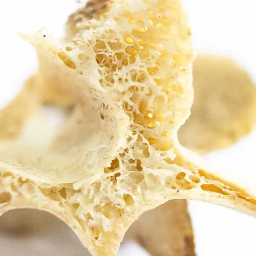 What Can a Bone Density Scan Tell You About Osteoporosis Risk?